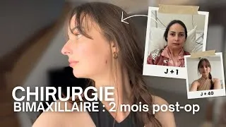 Miniature : Chirurgie maxillo-faciale : post-op 2 mois & reprise alimentation solide + astuces
