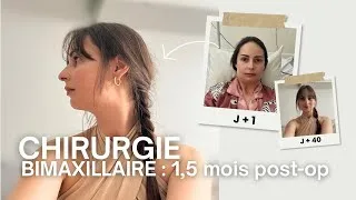 Miniature : Chirurgie Maxillo-faciale vlog : quoi manger en post-op (sans mâcher), idées repas & suivi post-op