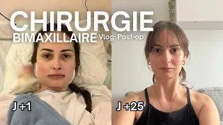 Miniature : Chirurgie Maxillo-Faciale : quoi manger après le post-op, idée repas à 1 mois post-op