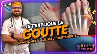Miniature : La Goutte : Pourquoi Ça Fait Si Mal ? Symptômes, Causes et Solutions ! 💥🦶