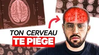 Miniature : Ton cerveau sabote tes décisions. Contourne le.