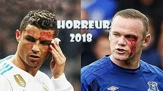 Miniature : Horribles Blessures dans le Foot 2018 | HD