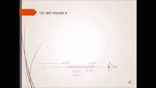 Miniature : Les défauts de l'oeil