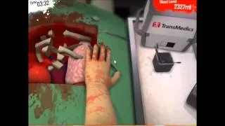 Miniature : [Surgeron simulator]Epic Noob