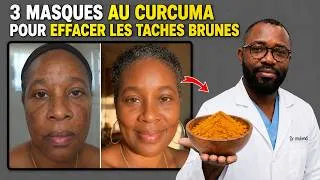 Miniature : APRÈS 55 ANS : Ces 3 Masques Au Curcuma Effacent Vraiment Vos Taches Brunes En 6 Semaines