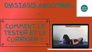 Miniature : Diastasis abdominal: Comment le tester et le corriger ?