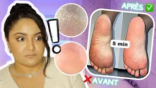 Miniature : COMMENT AVOIR DES PIEDS DOUX ET LISSES EN 5 MIN ! — Ma routine pieds (LOVASKIN)