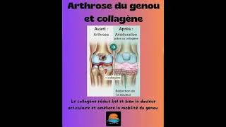 Miniature : La science valide le collagène pour soulager l'arthrose du genou (Naturosoutien)