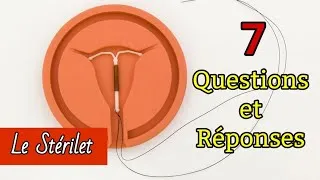 Miniature : Stérilet : Tout ce que vous devez savoir sur le DIU : vos questions, répondues