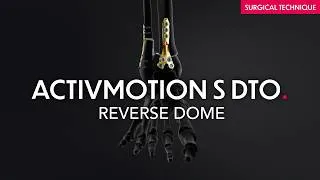 Miniature : Activmotion S DTO - Reverse dome - Distal tibial osteotomy plates - Surgical technique