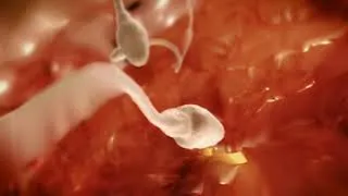 Miniature : La fécondation 2018 (Remake l'Odyssée de la vie de Nils Tavernier 2005)