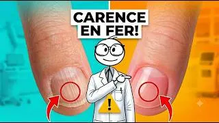 Miniature : Les astuces pour que ton corps absorbe le plus de Fer ?