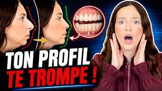 Miniature : Tu Crois Avoir Un Gros Nez ? Regarde D’abord Ta MÂCHOIRE
