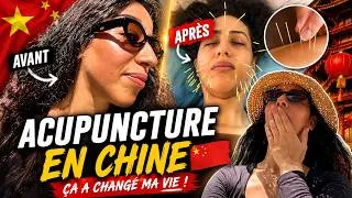 Miniature : 😱 Mon expérience de l'acupuncture chinoise🇨🇳 Pourquoi les Chinois font ça ?
