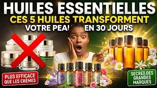 Miniature : BEAUTÉ ET PEAU : 5 HUILES ESSENTIELLES QUI TRANSFORMENT VOTRE PEAU EN 30 JOURS