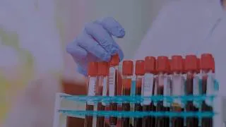 Miniature : Monoclonal Gammopathy Of Undetermined Significance (MGUS) 101 - Types of MGUS