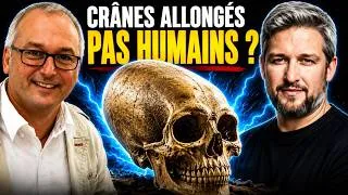 Miniature : Crânes allongés : étaient-ils vraiment humains ? | Avec Patrice Marty