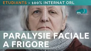 Miniature : Paralysie Faciale a frigore | 100% Internat ORL | Episode #1