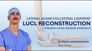 Miniature : Elbow LUCL Reconstruction – Mini-Invasive Knotless Onlay Technique for PLRI | Step-by-Step Surgery
