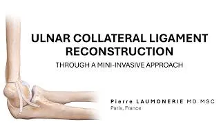 Miniature : Elbow UCL Reconstruction: Mini-Invasive Knotless Technique (Ant/ Post Bundles): Step-by-Step Surgery