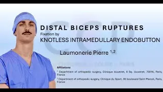 Miniature : Distal Biceps Tendon Repair – Mini-Open Intramedullary EndoButton Fixation (Step-by-Step)
