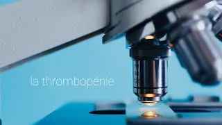 Miniature : أسئلة بيولوجي في الصحة العموميةquestions de concours biologistes/la thrombopénie