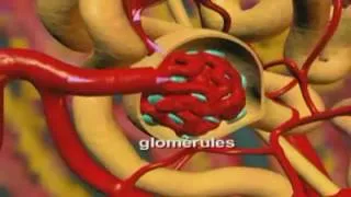 Miniature : Hypertension rénale