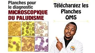 Miniature : Planches pour le Diagnostic Microscopique du Paludisme – OMS