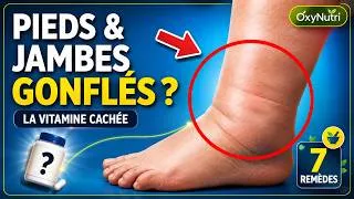 Miniature : Pieds et jambes gonflés ? Cette vitamine et ces aliments peuvent aider à réduire l’enflure 🤯💥