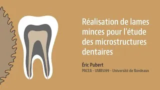 Miniature : Réalisations de lames minces pour l'étude des microstructures dentaires