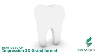 Miniature : Dent géante en Impression 3D Grand Format
