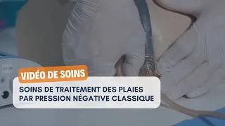 Miniature : Vidéo de soin : traitement des plaies par pression négative classique