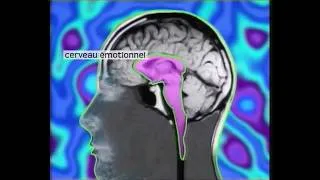 Miniature : Action du stress sur le cerveau