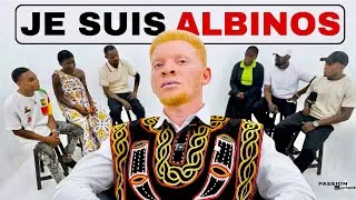 Miniature : Je suis un ALBINOS, posez moi  TOUTES VOS QUESTIONS 