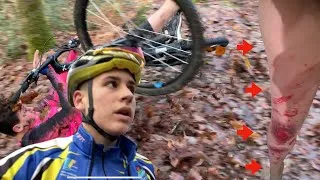 Miniature : J'APPREND A UN DEBUTANT LES BASES DU VTT  (il fait une grosse chute)