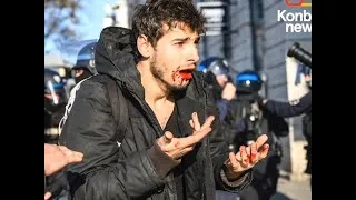 Miniature : Passé à tabac par la police, il perd 9 dents - Le Speech d’Arthur Naciri