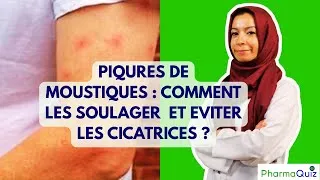 Miniature : piqure de moustique comment eviter cicatrise demangeaison piqure de moustique remede naturelle
