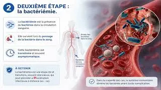 Miniature : infection osteoarticulaire