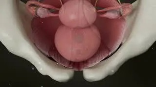 Miniature : Physiopelvi 2024 PQ