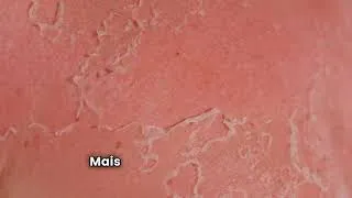 Miniature : Soleil  Amis ou Ennemi