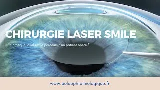 Miniature : Chirurgie réfractive laser SMILE. Pole Ophtalmologique.