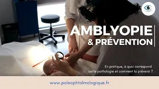 Miniature : L'amblyopie et sa prévention chez l'enfant. Pole Ophtalmologique.