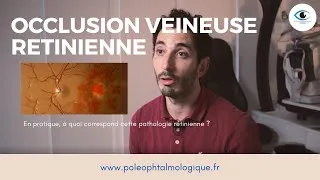 Miniature : Occlusion veineuse rétinienne. Pole ophtalmologique.