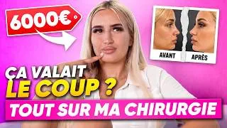Miniature : TOUTE LA VÉRITÉ SUR MES CHIRURGIES (Je vous explique tout..)