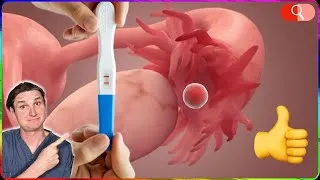 Miniature : MÉTHODE pour TOMBER ENCEINTE (fécondation, ovulation, …)