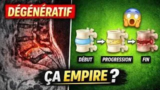 Miniature : Comment Évolue une Discopathie Dégénérative avec le Temps ?