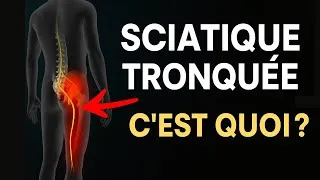 Miniature : Sciatique Tronquée : c’est quoi, pourquoi ça fait mal, et que faire ?