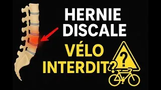Miniature : Peut-on faire du vélo avec une hernie discale ?