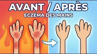 Miniature : Ce problème de mains peut venir de votre travail