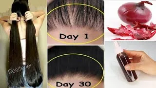 Miniature : Faites pousser vos cheveux plus rapidement  ! Testez la recette !!!
